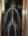Click image for larger version

Name:	HarrietColesDissectedNervousSystem.jpg
Views:	166
Size:	189.0 KB
ID:	376961